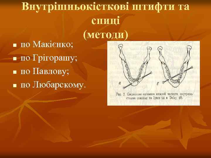 Внутрішньокісткові штифти та спиці (методи) n n по Макієнко; по Грігорашу; по Павлову; по