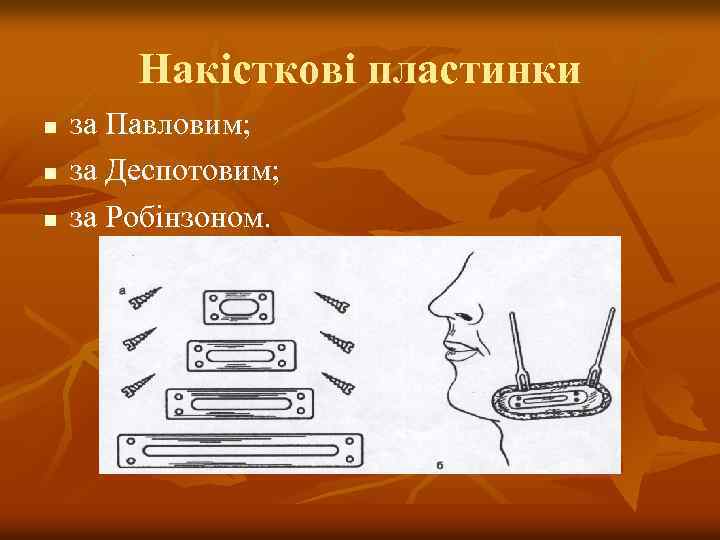 Накісткові пластинки n n n за Павловим; за Деспотовим; за Робінзоном. 