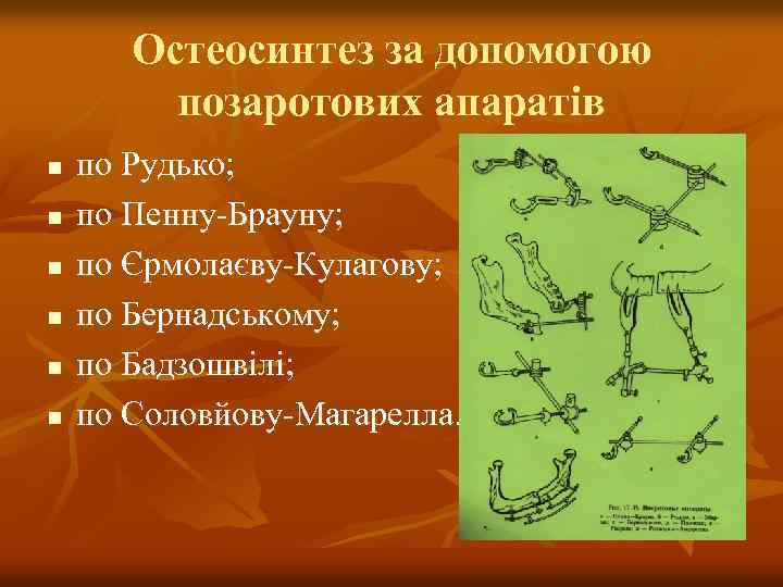 Остеосинтез за допомогою позаротових апаратів n n n по Рудько; по Пенну-Брауну; по Єрмолаєву-Кулагову;