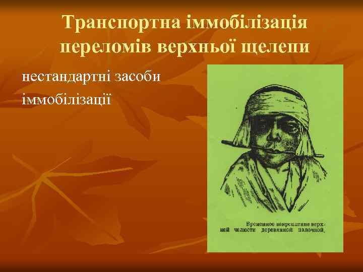 Транспортна іммобілізація переломів верхньої щелепи нестандартні засоби іммобілізації 