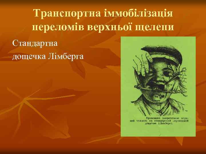 Транспортна іммобілізація переломів верхньої щелепи Стандартна дощечка Лімберга 