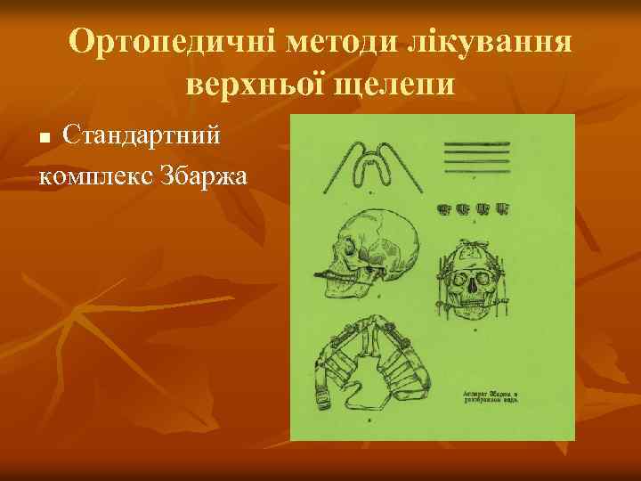 Ортопедичні методи лікування верхньої щелепи Стандартний комплекс Збаржа n 