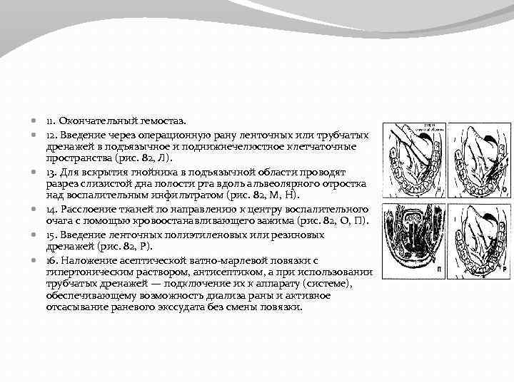  11. Окончательный гемостаз. 12. Введение через операционную рану ленточных или трубчатых дренажей в