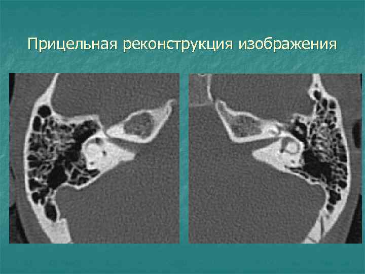 Прицельная реконструкция изображения 