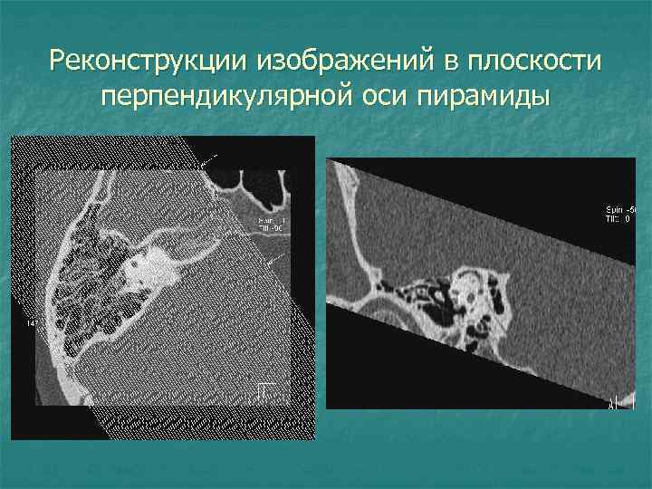 Реконструкции изображений в плоскости перпендикулярной оси пирамиды 