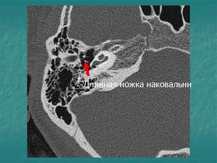 Длинная ножка наковальни 