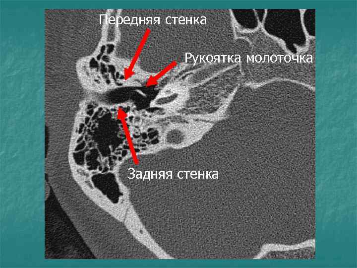 Передняя стенка Рукоятка молоточка Задняя стенка 