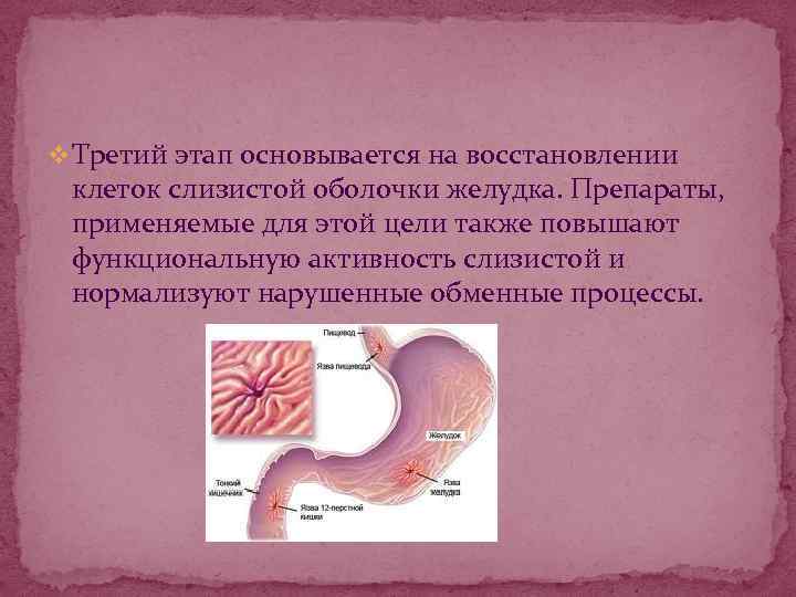 v Третий этап основывается на восстановлении клеток слизистой оболочки желудка. Препараты, применяемые для этой