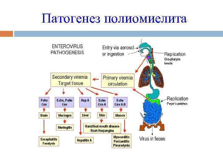 Патогенез полиомиелита 