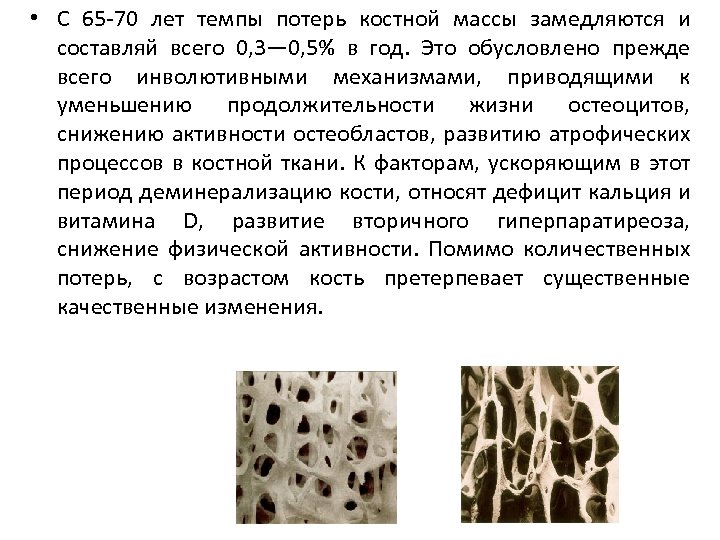  • С 65 70 лет темпы потерь костной массы замедляются и составляй всего