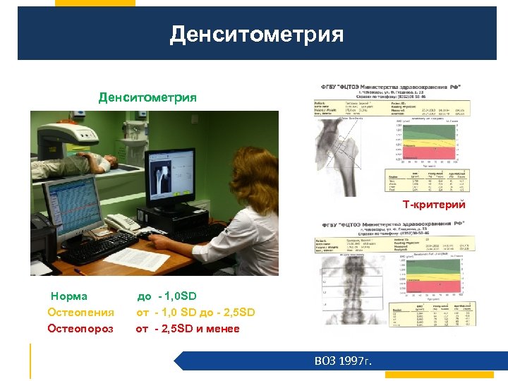 Денситометрия Т-критерий Норма Остеопения Остеопороз до - 1, 0 SD от - 1, 0