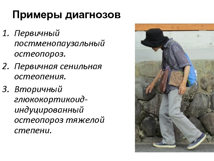 Примеры диагнозов 1. Первичный постменопаузальный остеопороз. 2. Первичная сенильная остеопения. 3. Вторичный глюкокортикоид индуцированный