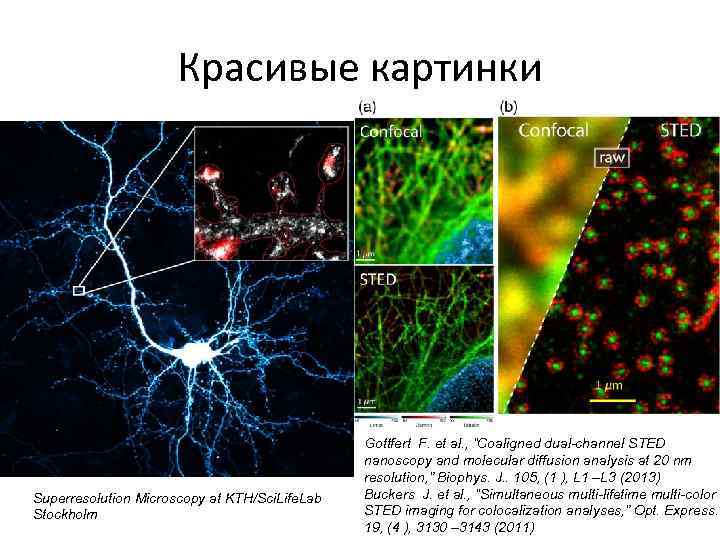 Красивые картинки Superresolution Microscopy at KTH/Sci. Life. Lab Stockholm Gottfert F. et al. ,