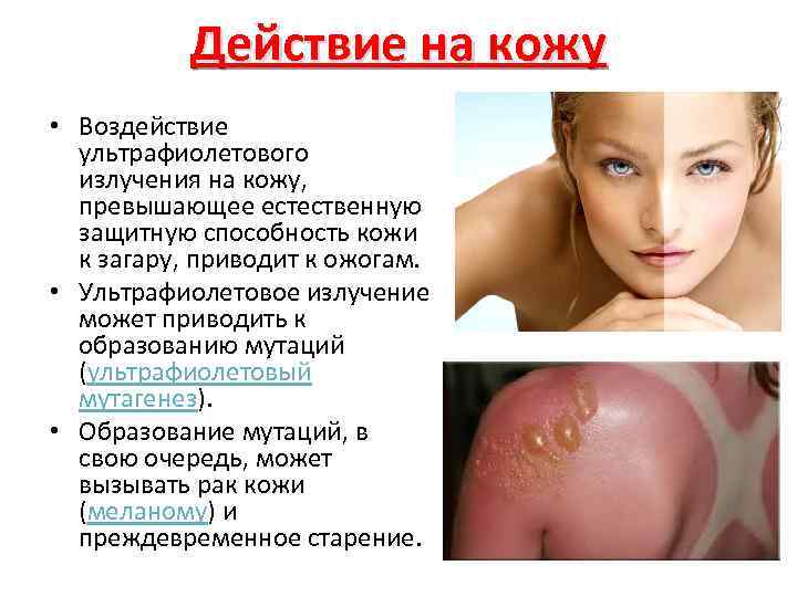 Действие на кожу • Воздействие ультрафиолетового излучения на кожу, превышающее естественную защитную способность кожи