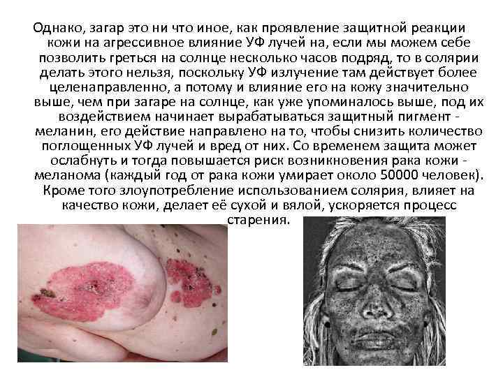 Однако, загар это ни что иное, как проявление защитной реакции кожи на агрессивное влияние
