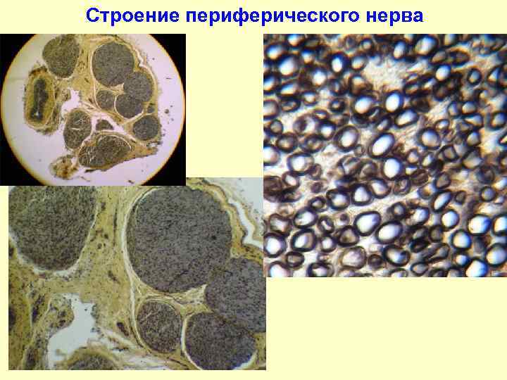 Строение периферического нерва 