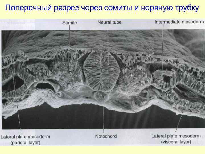 Поперечный разрез через сомиты и нервную трубку 