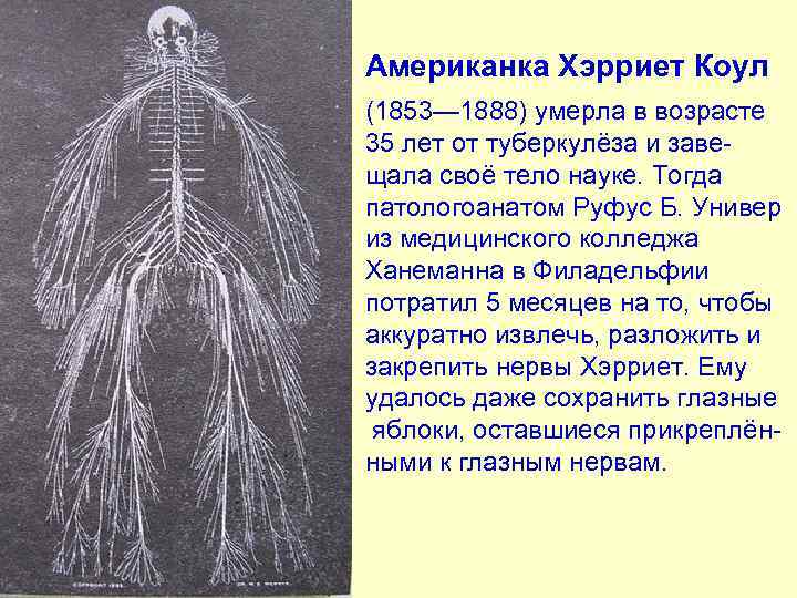 Американка Хэрриет Коул (1853— 1888) умерла в возрасте 35 лет от туберкулёза и заве