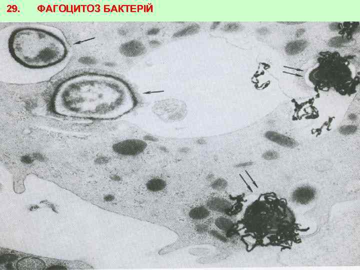29. ФАГОЦИТОЗ БАКТЕРІЙ 