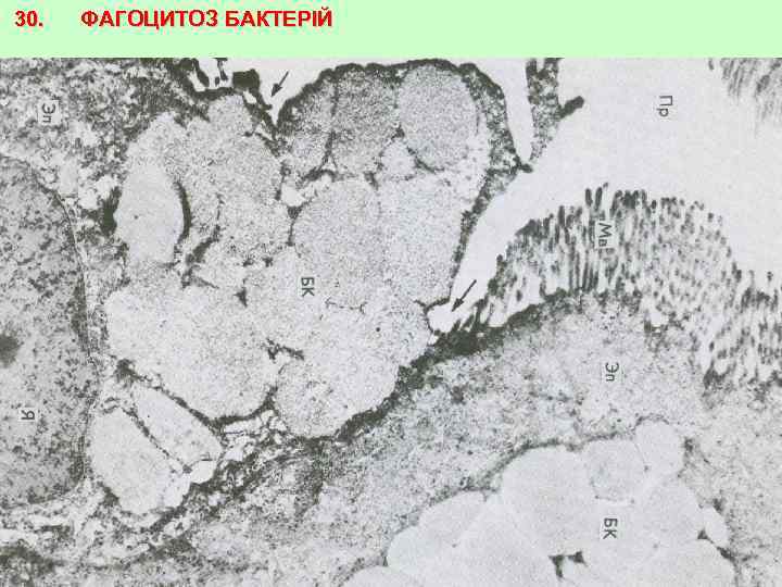 30. ФАГОЦИТОЗ БАКТЕРІЙ 