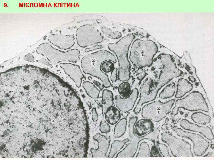 9. МІЄЛОМНА КЛІТИНА 