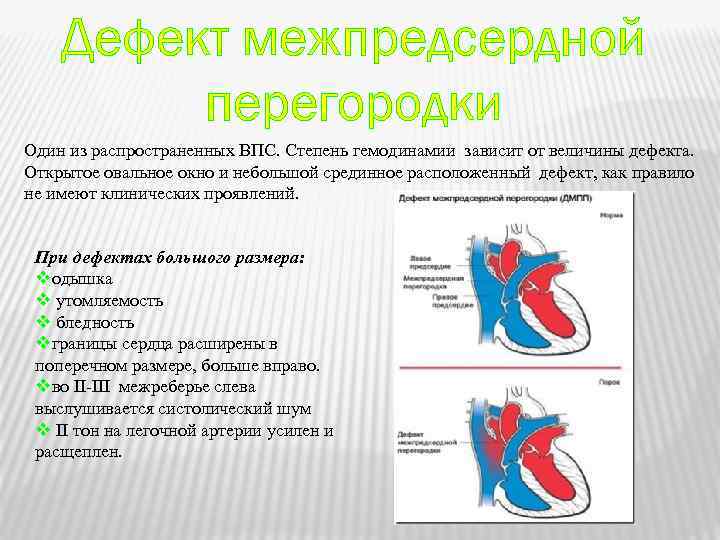 Дефект межпредсердной перегородки Один из распространенных ВПС. Степень гемодинамии зависит от величины дефекта. Открытое