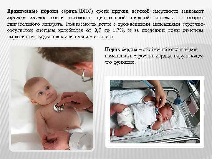 Врожденные пороки сердца (ВПС) среди причин детской смертности занимают третье место после патологии центральной