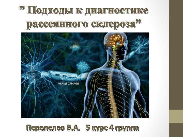 ” Подходы к диагностике рассеянного склероза” Перепелов В. А. 5 курс 4 группа 