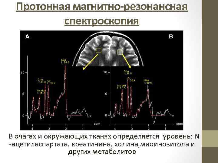 Изображение взвешенное по протонной плотности