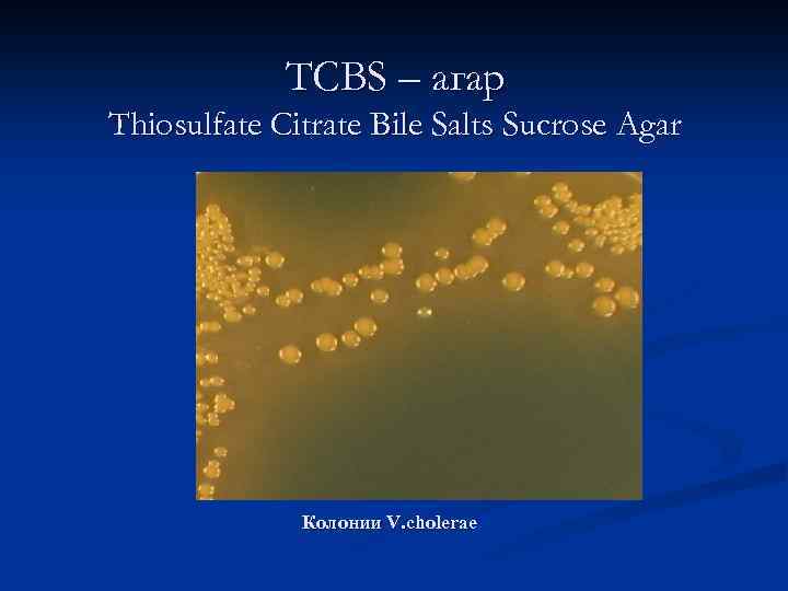 ТСВS – агар Thiosulfate Citrate Bile Salts Sucrose Agar Колонии V. cholerae 