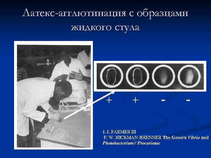 Латекс-агглютинация с образцами жидкого стула + + - - J. J. FARMER III F.