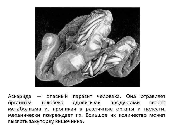 Аскарида — опасный паразит человека. Она отравляет организм человека ядовитыми продуктами своего метаболизма и,