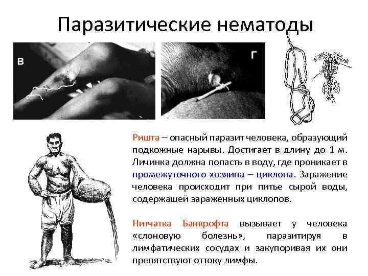 Паразитические нематоды Ришта – опасный паразит человека, образующий подкожные нарывы. Достигает в длину до