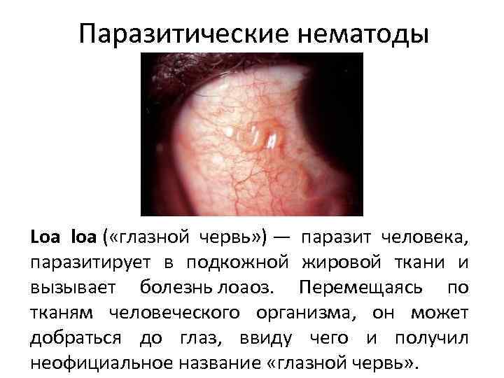Паразитические нематоды Loa loa ( «глазной червь» ) — паразит человека, паразитирует в подкожной