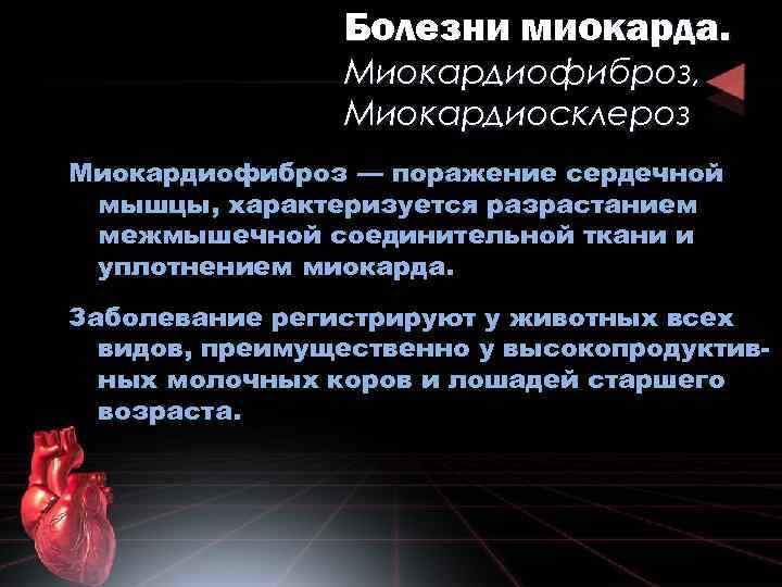 Болезни миокарда. Миокардиофиброз, Миокардиосклероз Миокардиофиброз — поражение сердечной мышцы, характеризуется разрастанием межмышечной соединительной ткани