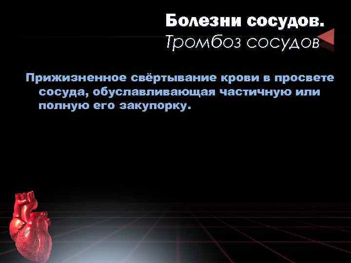 Болезни сосудов. Тромбоз сосудов Прижизненное свёртывание крови в просвете сосуда, обуславливающая частичную или полную