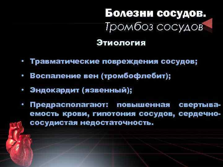 Болезни сосудов. Тромбоз сосудов Этиология • Травматические повреждения сосудов; • Воспаление вен (тромбофлебит); •