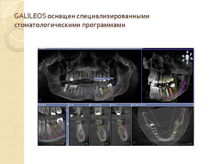 GALILEOS оснащен специализированными стоматологическими программами 