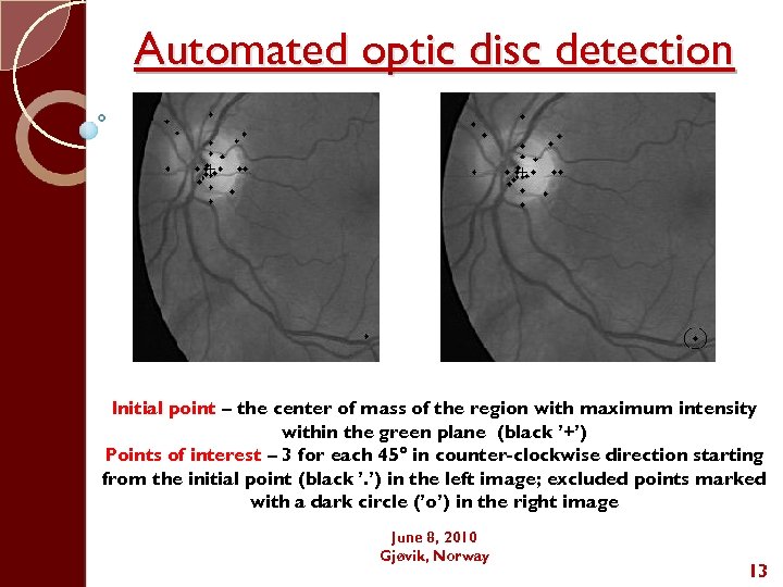 Automated optic disc detection Initial point – the center of mass of the region