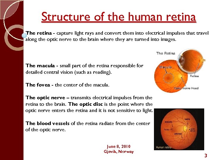 Structure of the human retina The retina - capture light rays and convert them