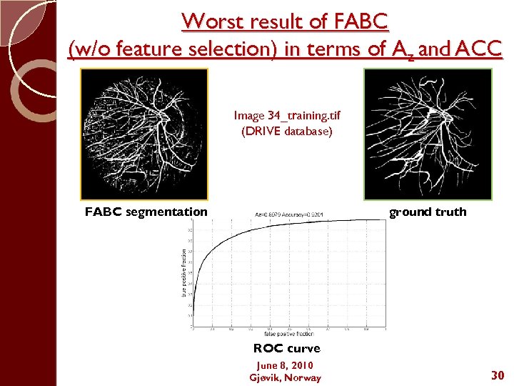Worst result of FABC (w/o feature selection) in terms of Az and ACC Image