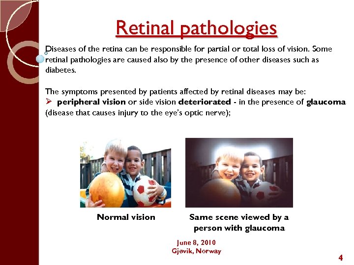 Retinal pathologies Diseases of the retina can be responsible for partial or total loss