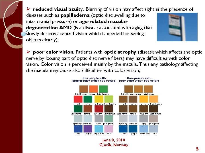 Ø reduced visual acuity. Blurring of vision may affect sight in the presence of