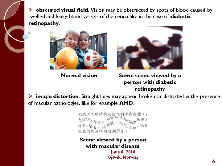 Ø obscured visual field. Vision may be obstructed by spots of blood caused by