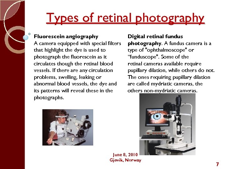Types of retinal photography Fluorescein angiography A camera equipped with special filters that highlight