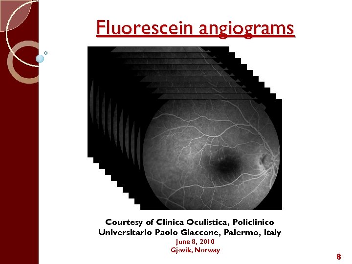 Fluorescein angiograms Courtesy of Clinica Oculistica, Policlinico Universitario Paolo Giaccone, Palermo, Italy June 8,
