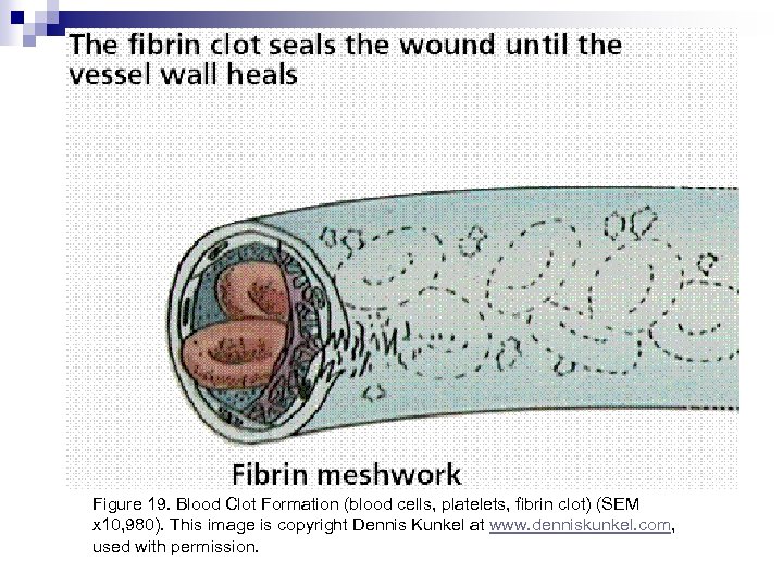 Figure 19. Blood Clot Formation (blood cells, platelets, fibrin clot) (SEM x 10, 980).