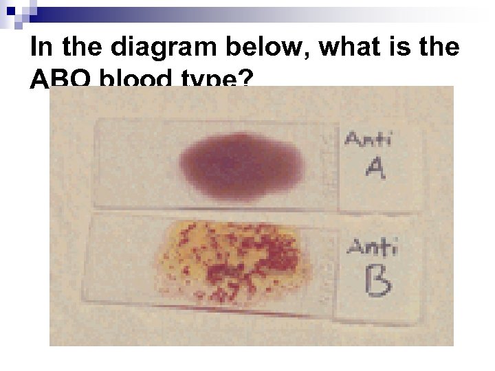 In the diagram below, what is the ABO blood type? 