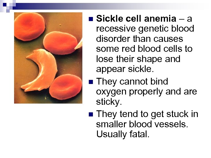 Sickle cell anemia – a recessive genetic blood disorder than causes some red blood