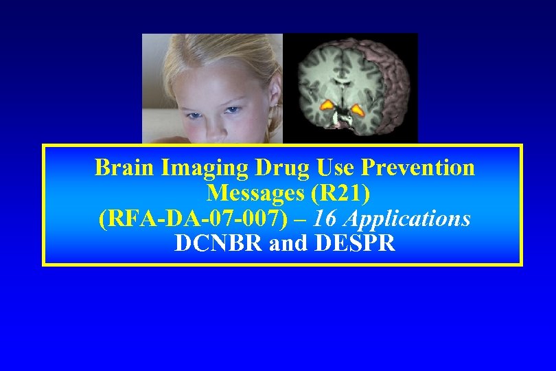 Brain Imaging Drug Use Prevention Messages (R 21) (RFA-DA-07 -007) – 16 Applications DCNBR